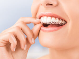 invisalign