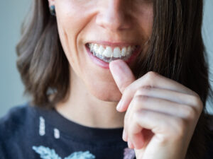 invisalign