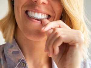 benefícios do invisalign